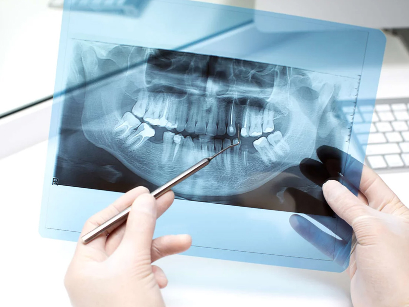 Инструкция по отправке снимка в стоматологию